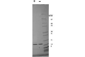 SDS-PAGE of Human Interferon-alpha 2b Recombinant Protein SDS-PAGE of Human Interferon-alpha 2B Recombinant Protein. (IFNA2 Protein)