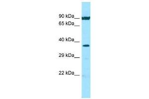 Host: Rabbit  Target Name: NFKBIA  Sample Tissue: Hela Whole Cell lysates  Antibody Dilution: 1. (NFKBIA Antikörper  (N-Term))
