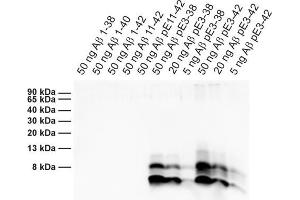 Detection of different synthetic Abeta species (dilution 1 : 1000). (Abeta-pE3 Antikörper)