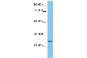 Host:  Mouse  Target Name:  MXI1  Sample Tissue:  Mouse Brain  Antibody Dilution:  1ug/ml (MXI1 Antikörper  (Middle Region))