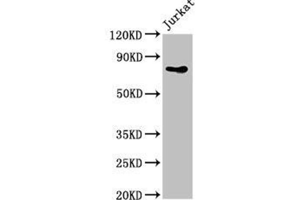 PIK3R2 Antikörper  (Regulatory Subunit beta)