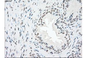 Immunohistochemical staining of paraffin-embedded Ovary tissue using anti-PLK1mouse monoclonal antibody. (PLK1 Antikörper)
