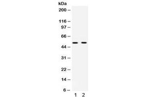 Western blot testing of 1) rat brain and 2) human HeLa lysate with UBE1C antibody. (UBA3 Antikörper)