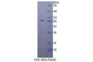 SDS-PAGE (SDS) image for Elastin (ELN) (AA 392-645) protein (His tag) (ABIN1079383) (Elastin Protein (ELN) (AA 392-645) (His tag))