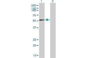 Western Blot analysis of GALNS expression in transfected 293T cell line by GALNS MaxPab polyclonal antibody. (GALNS Antikörper  (AA 1-522))