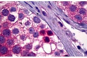 Anti-PDK1 antibody IHC staining of human testis, spermatogonia. (PDPK1 Antikörper)