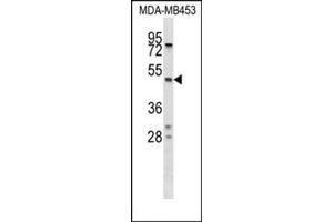 Western blot analysis of SERPINA5 Antibody (N-term) Cat. (SERPINA5 Antikörper  (N-Term))