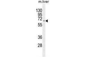 Western blot analysis in mouse liver tissue lysates (35ug/lane) using KY Antibody (N-term). (Kyphoscoliosis Peptidase Antikörper  (N-Term))