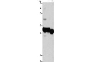 Western Blotting (WB) image for anti-Ketohexokinase (KHK) antibody (ABIN2422887) (Ketohexokinase Antikörper)