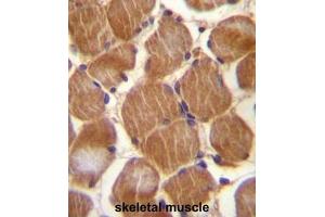 ASAM Antibody (Center) immunohistochemistry analysis in formalin fixed and paraffin embedded human skeletal muscle followed by peroxidase conjugation of the secondary antibody and DAB staining. (CLMP Antikörper  (Middle Region))