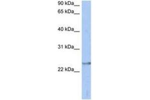 Image no. 1 for anti-ATPase, H+ Transporting, Lysosomal 31kDa, V1 Subunit E2 (ATP6V1E2) (AA 71-120) antibody (ABIN6744287) (ATP6V1E2 Antikörper  (AA 71-120))