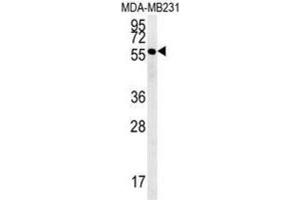 Western Blotting (WB) image for anti-RAB11 Family Interacting Protein 2 (Class I) (RAB11FIP2) antibody (ABIN3002357) (RAB11FIP2 Antikörper)