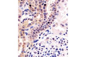 (ABIN6243947 and ABIN6578467) staining PHC3 in human kidney tissue sections by Immunohistochemistry (IHC-P - paraformaldehyde-fixed, paraffin-embedded sections). (PHC3 Antikörper  (AA 819-850))