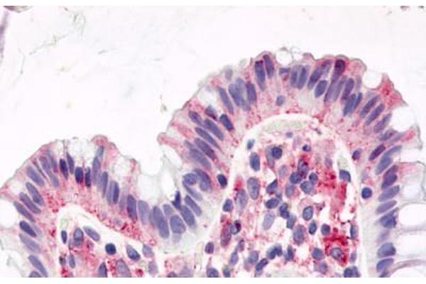 GPR15 Antikörper  (Cytoplasmic Domain)