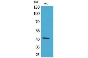 Western Blotting (WB) image for anti-alpha-SMA (C-Term) antibody (ABIN3180983) (alpha-SMA (C-Term) Antikörper)