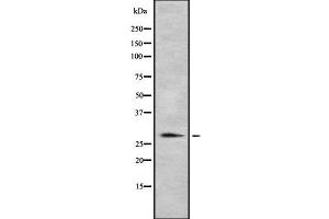 Western blot analysis of HLA-DRB1 using MCF7 whole cell lysates (HLA-DRB1 Antikörper)