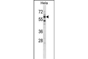 Western blot analysis in Hela cell line lysates (35ug/lane). (ADCK5 Antikörper  (N-Term))