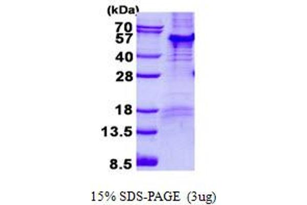 PARD6B Protein (His tag)