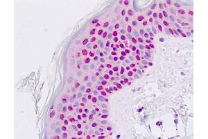Anti-PAX7 antibody IHC staining of human skin, epidermis. (PAX7 Antikörper  (AA 410-437))