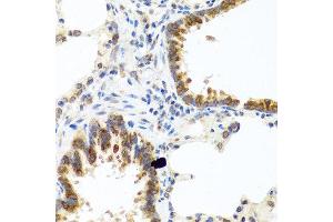 Immunohistochemistry of paraffin-embedded rat lung using C8orf4 antibody at dilution of 1:100 (40x lens). (C8orf4 Antikörper)