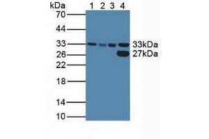 Figure. (CDK2 Antikörper  (AA 94-198))