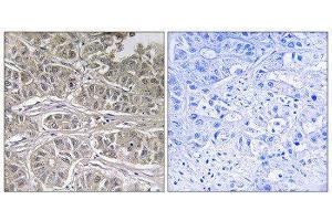 Immunohistochemistry (IHC) image for anti-Solute Carrier Family 25 (Mitochondrial Oxodicarboxylate Carrier), Member 21 (Slc25a21) (Internal Region) antibody (ABIN1851571) (SLC25A21 Antikörper  (Internal Region))