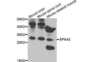 Western Blotting (WB) image for anti-Ephrin A3 (EFNA3) (AA 23-214) antibody (ABIN6219775) (Ephrin A3 Antikörper  (AA 23-214))