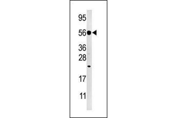 DUSP8 Antikörper  (C-Term)