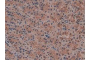 IHC-P analysis of Rat Stomach Tissue, with DAB staining. (OTUB1 Antikörper  (AA 1-271))