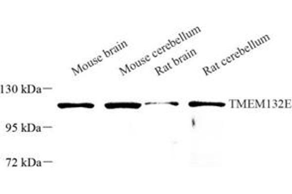 TMEM132E Antikörper