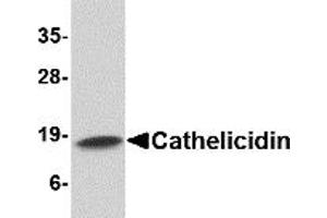 Western Blotting (WB) image for anti-Cathelicidin Antimicrobial Peptide (CAMP) (C-Term) antibody (ABIN1030321) (Cathelicidin Antikörper  (C-Term))