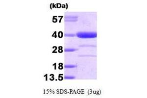 Alcohol Dehydrogenase (ADH) (AA 1-325) Protein