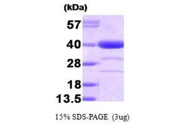 Alcohol Dehydrogenase (ADH) (AA 1-325) Protein