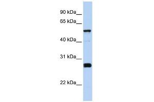 FAM83F antibody used at 1 ug/ml to detect target protein. (FAM83F Antikörper  (Middle Region))