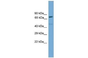 WB Suggested Anti-Trp73 Antibody Titration:  0. (Tumor Protein p73 Antikörper  (N-Term))