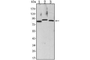 Western Blot showing CHUK antibody used against Raji (1), Jurkat (2) and THP-1 (3) cell lysate. (IKK alpha Antikörper)