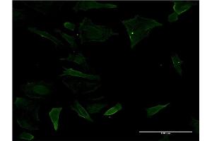 Immunofluorescence of monoclonal antibody to CD19 on HeLa cell. (CD19 Antikörper  (AA 98-187))
