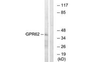 Western Blotting (WB) image for anti-G Protein-Coupled Receptor 62 (GPR62) (AA 181-230) antibody (ABIN2890876) (GPR62 Antikörper  (AA 181-230))