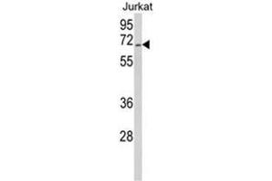 Western blot analysis of RBM14 Antibody (Center) in Jurkat cell line lysates (35ug/lane). (RBM14 Antikörper  (Middle Region))