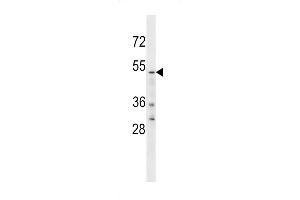 Western blot analysis in U251 cell line lysates (35ug/lane). (YTHDF2 Antikörper  (C-Term))