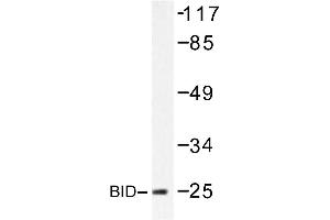 Image no. 1 for anti-BH3 Interacting Domain Death Agonist (BID) antibody (ABIN272120) (BID Antikörper)