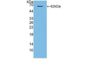 Detection of Recombinant CD40L, Human using Polyclonal Antibody to Cluster Of Differentiation 40 Ligand (CD40L) (CD40 Ligand Antikörper  (AA 1-261))