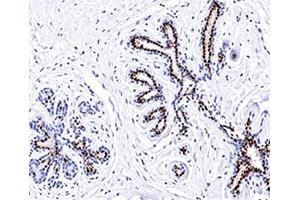 IHC testing of normal human breast stained with Progesterone receptor antibody (PR501). (Progesterone Receptor Antikörper)