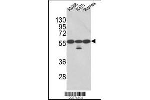Western blot analysis of PDIA3 Antibody in A2058, A375, Ramos cell line lysates (35ug/lane)(2ug/ml) (PDIA3 Antikörper  (AA 192-220))
