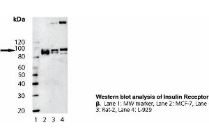 Image no. 1 for anti-Insulin Receptor (INSR) (Cytoplasmic Domain) antibody (ABIN331470) (Insulin Receptor Antikörper  (Cytoplasmic Domain))