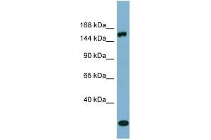 WB Suggested Anti-EPRS  Antibody Titration: 0. (EPRS Antikörper  (Middle Region))