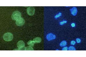 Immunocytochemistry staining of alpha-tubulin in K562 cells using purified rat monoclonal antibody YOL1/34 (concentration in sample 6 μg/mL, DAR FITC, left picture) vs. (alpha Tubulin Antikörper)