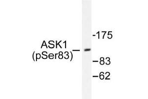 Image no. 1 for anti-Mitogen-Activated Protein Kinase Kinase Kinase 5 (MAP3K5) (pSer83) antibody (ABIN317961) (ASK1 Antikörper  (pSer83))