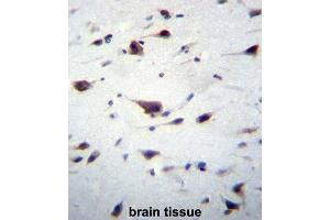 Immunohistochemistry (IHC) image for anti-Phosphatidylinositol-3,4,5-Trisphosphate-Dependent Rac Exchange Factor 1 (PREX1) antibody (ABIN2996829) (PREX1 Antikörper)