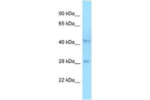 WB Suggested Anti-B4galt3 Antibody   Titration: 1. (B4GALT3 Antikörper  (C-Term))
